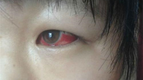 光觸媒除甲醛保護(hù)新裝修教室空氣，更保護(hù)孩子們